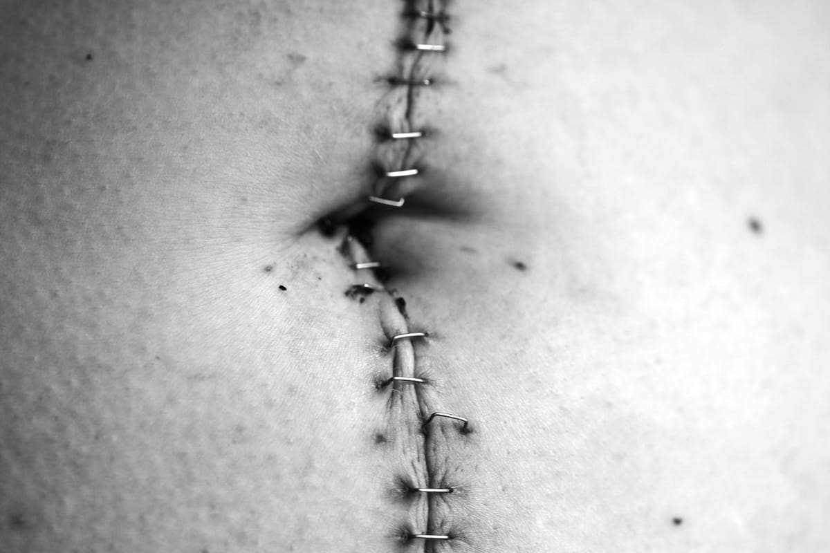 Week Four: Calling.            January 22: What Wound might Flower into Calling?